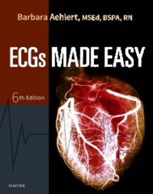 ECGs Made Easy 6E Aehlert TEST BANK