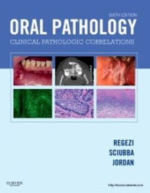 Oral Pathology Clinical Pathologic Correlations 6E Regezi TEST BANK